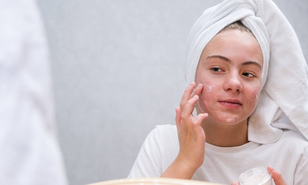 OTKRIJ SVOJ TIP KOŽE Jednostavan test koji može da promeni vašu rutinu nege!