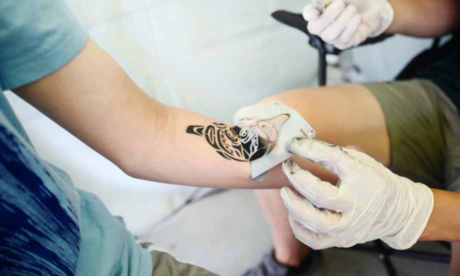 ŽELITE TETOVAŽU? Evo koje bolesti mogu da je učine opasnom i kada morate biti posebno oprezni