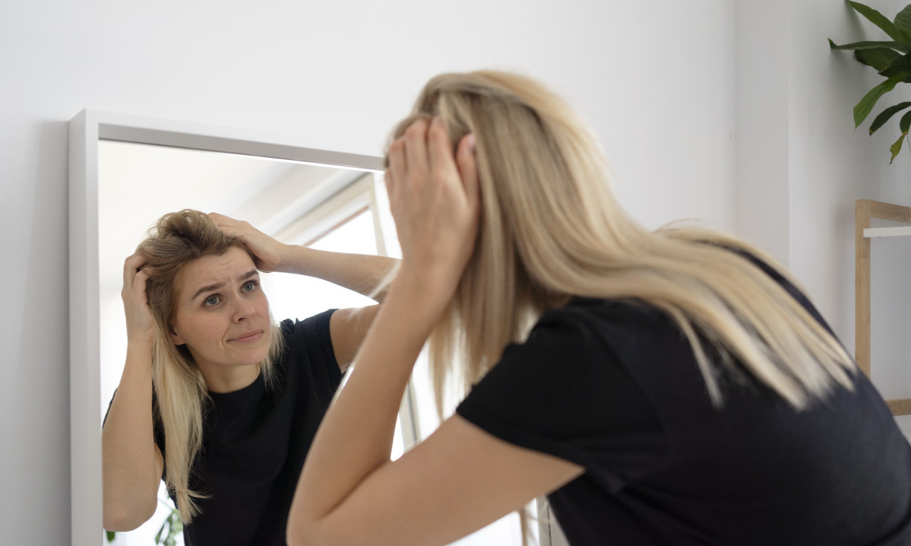 REŠITE SE PERUTI KONAČNO Koraci koje morate probati ako ništa drugo nije pomoglo!