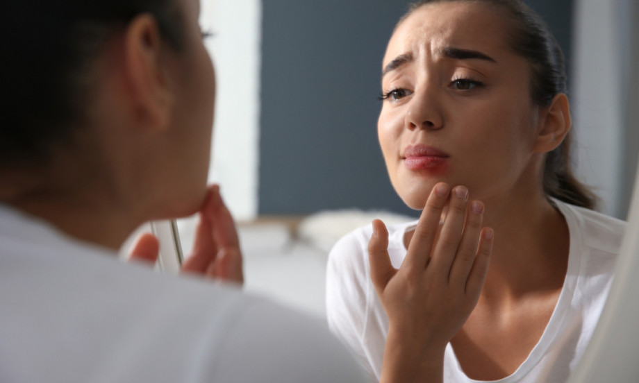 OVO ZAISTA POMAŽE ZA HERPES Kako ga najbrže izlečiti