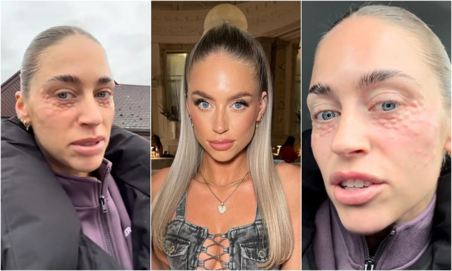 DOKLE IDE OVAJ SVET Stavila na lice spermu, pogledajte na šta sad liči (VIDEO)