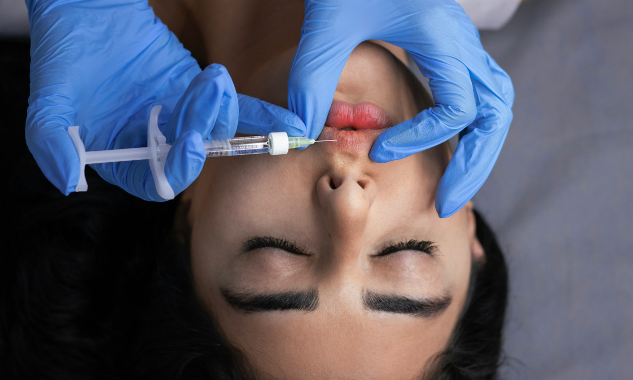 PUT DO LEPŠIH I PRIRODNIJIH USANA Zašto su lip busteri sve traženiji od hijaluronskih filera