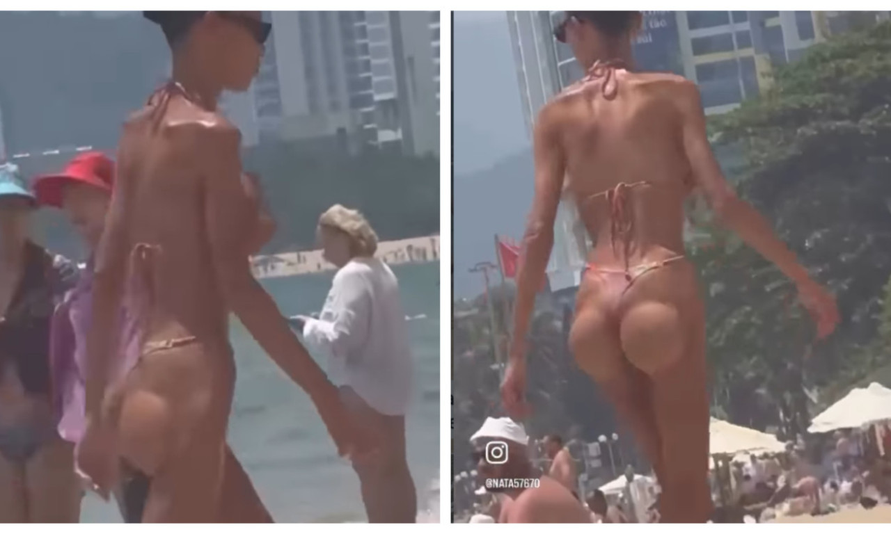 KAD ESTETIKA IZGUBI MERU Najčešće greške zbog kojih telo može izgledati neprirodno (VIDEO)